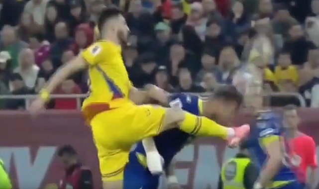 Edin Dzeko'nun Burnu Kırıldı, İkinci Yarıda Oyundan Çıktı