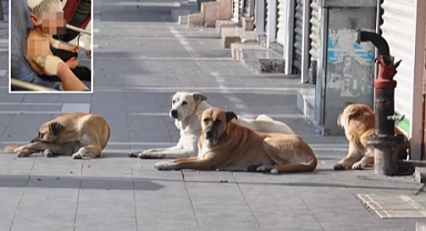 Sokak Köpeği Saldırısı: 9 Yaşındaki Çocuk Ölümden Döndü