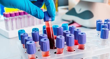 Dünyada Sadece Bir Kişide Bulunan Yeni Kan Grubu “Gwada Negatif” Resmen Tanındı